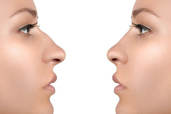 Mejor cirujano rinoplastia España